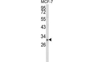 Western Blotting (WB) image for anti-NK3 Homeobox 1 (NKX3-1) antibody (ABIN3003998)