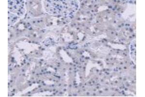 Detection of AGXT2 in Rat Kidney Tissue using Polyclonal Antibody to Alanine Glyoxylate Aminotransferase 2 (AGXT2)