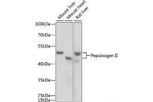Western blot analysis of extracts of various cell lines using Pepsinogen II Polyclonal Antibody at dilution of 1:1000. (PGC Antikörper)