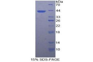 SDS-PAGE (SDS) image for Platelet Factor 4 (PF4) (AA 17-104) protein (His tag,GST tag) (ABIN2123484)