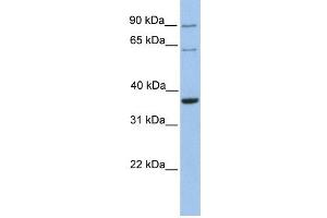 TMEM123 antibody used at 1 ug/ml to detect target protein. (TMEM123 Antikörper  (C-Term))