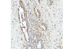 IHC analysis of Grp75 using anti-Grp75 antibody (ABIN7602782). (HSPA9 Antikörper  (C-Term))