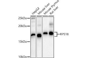 Western blot analysis of extracts of various cell lines, using RPS18 antibody (ABIN6128660, ABIN6147205, ABIN6147206 and ABIN6215379) at 1:1000 dilution. (RPS18 Antikörper  (AA 1-152))