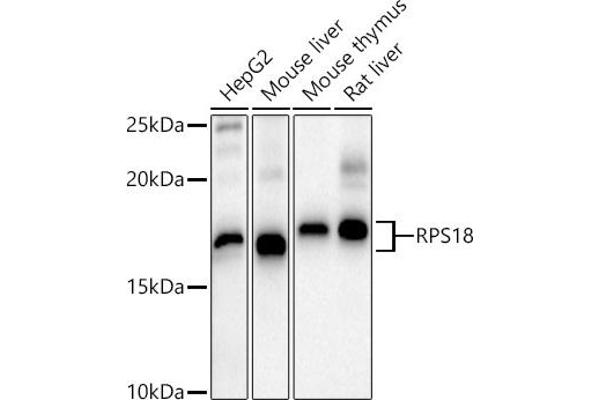 RPS18 Antikörper  (AA 1-152)