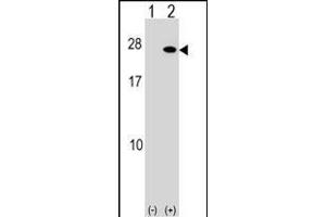 Western blot analysis of FGF19 (arrow) using rabbit polyclonal FGF19 Antibody (C-term) (ABIN1536785 and ABIN2849728). (FGF19 Antikörper  (C-Term))