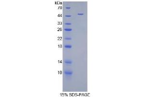 SDS-PAGE analysis of Mouse Androgen Receptor Protein. (Androgen Receptor Protein (AR))