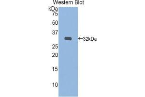 Western blot analysis of the recombinant protein. (IDS Antikörper  (AA 180-448))