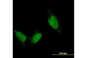 Image no. 1 for anti-Titin (TTN) (AA 1-111) antibody (ABIN598990) (Titin Antikörper  (AA 1-111))