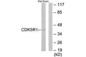 Western Blotting (WB) image for anti-Cyclin-Dependent Kinase 5, Regulatory Subunit 1 (p35) (CDK5R1) (AA 11-60) antibody (ABIN2889601) (CDK5R1 Antikörper  (AA 11-60))