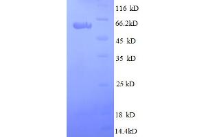 SDS-PAGE (SDS) image for Secreted Protein, Acidic, Cysteine-Rich (Osteonectin) (SPARC) (AA 18-303) protein (GST tag) (ABIN5712686)