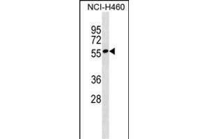 ZN Antibody (N-term) (ABIN1539437 and ABIN2849988) western blot analysis in NCI- cell line lysates (35 μg/lane). (ZNF302 Antikörper  (N-Term))