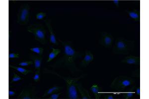 Immunofluorescence of monoclonal antibody to LCAT on HeLa cell. (LCAT Antikörper  (AA 98-197))
