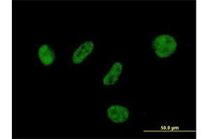 Immunofluorescence of purified MaxPab antibody to BAP1 on HeLa cell. (BAP1 Antikörper  (AA 1-729))