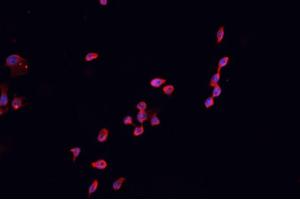ABIN6266609 staining HEK 293 cells by IF/ICC. (CDKN2B Antikörper  (Internal Region))