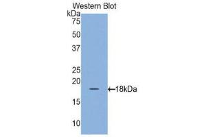 Western Blotting (WB) image for anti-Retinol Binding Protein 1, Cellular (RBP1) (AA 1-135) antibody (ABIN1860410)