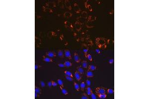 Immunofluorescence analysis of NIH-3T3 cells using SOD2 antibody (ABIN7270638). (SOD2 Antikörper)