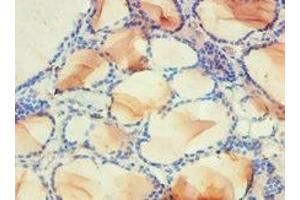 Immunohistochemistry of paraffin-embedded human thyroid tissue using ABIN7142339 at dilution of 1:100 (PDPK1 Antikörper  (AA 277-556))