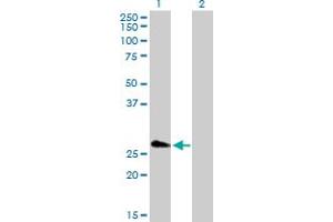 Western Blot analysis of FHL5 expression in transfected 293T cell line by FHL5 MaxPab polyclonal antibody. (FHL5 Antikörper  (AA 1-284))