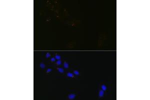 Immunofluorescence analysis of U-2 OS cells using GR Rabbit mAb (ABIN1679751, ABIN3015980, ABIN3015981 and ABIN7101472) at dilution of 1:100 (40x lens). (GORASP1 Antikörper)