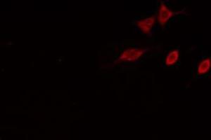 ABIN6274837 staining HeLa cells by IF/ICC. (AMPD2 Antikörper  (N-Term))