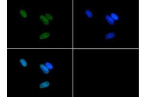 Immunofluorescence of Rabbit Anti-Histone H3 [Asym-dimethyl Arg17] Antibody. (Histone 3 Antikörper  (H3R17me2a))
