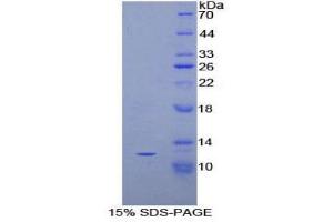 SDS-PAGE (SDS) image for Peptide YY (PYY) (AA 30-98) protein (His tag) (ABIN1879992)