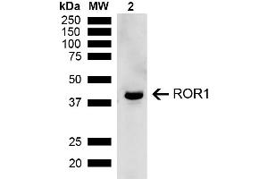 Western blot analysis of Rat Kidney showing detection of ~43 kDa ROR1 protein using Rabbit Anti-ROR1 Polyclonal Antibody (ABIN5667808). (ROR1 Antikörper  (AA 200-300) (PE))
