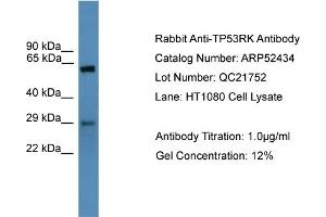 WB Suggested Anti-TP53RK  Antibody Titration: 0. (TP53RK Antikörper  (N-Term))