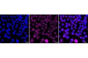 anti-HRas proto-oncogene, GTPase (HRAS) antibody