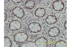 Image no. 1 for anti-Tousled-Like Kinase 2 (TLK2) (AA 1-126) antibody (ABIN599164) (TLK2 Antikörper  (AA 1-126))