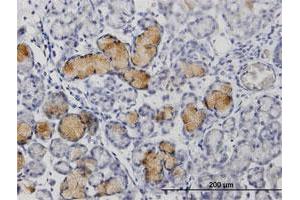Immunohistochemistry (Formalin-fixed Paraffin-embedded Sections) (IHC (fp)) image for anti-Matrix Metallopeptidase 1 (Interstitial Collagenase) (MMP1) (AA 1-469) antibody (ABIN948134)