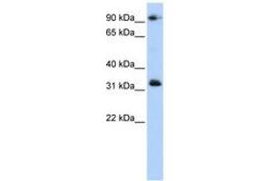 Image no. 1 for anti-Coiled-Coil Domain Containing 69 (CCDC69) (C-Term) antibody (ABIN6741306) (CCDC69 Antikörper  (C-Term))