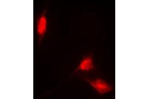 Immunofluorescent analysis of NRF2 staining in HL60 cells. (NRF2 Antikörper  (C-Term))