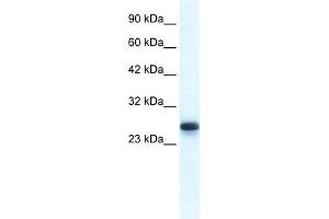 WB Suggested Anti-HMGB1 Antibody Titration:  1. (HMGB1 Antikörper  (Middle Region))