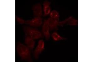ABIN6275289 staining Hela by IF/ICC. (Nesprin3 Antikörper  (N-Term))