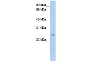 PARK7 antibody used at 1 ug/ml to detect target protein. (PARK7/DJ1 Antikörper)