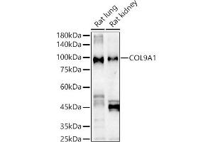 Western blot analysis of extracts of various cell lines, using COL9 Rabbit pAb antibody (ABIN6127648, ABIN6138849, ABIN6138851 and ABIN6222235) at 1:1000 dilution. (COL9A1 Antikörper  (AA 20-270))