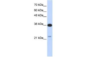 Western Blotting (WB) image for anti-TP53 Target 5 (TP53TG5) antibody (ABIN2459705) (TP53TG5 Antikörper)