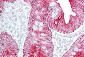 Immunohistochemistry (IHC) image for anti-Keratin 8 (KRT8) (N-Term) antibody (ABIN2777112)