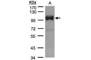 WB Image Sample(30 μg of whole cell lysate) A:HeLa S3, 7. (TRPC6 Antikörper  (C-Term))