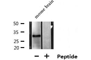 Western blot analysis of extracts from Mouse brain lysate, using MTAP antibody. (MTAP Antikörper  (Internal Region))