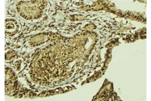ABIN6269152 at 1/100 staining Mouse colon tissue by IHC-P. (ATF2 Antikörper  (N-Term))