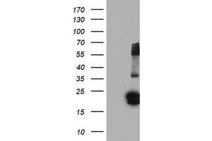 Western Blotting (WB) image for anti-Fibroblast Growth Factor 21 (FGF21) (AA 29-209) antibody (ABIN1491337)