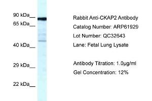 Western Blotting (WB) image for anti-Cytoskeleton Associated Protein 2 (CKAP2) (C-Term) antibody (ABIN786518) (CKAP2 Antikörper  (C-Term))