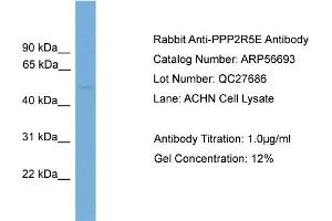 Western Blotting (WB) image for anti-Protein Phosphatase 2, Regulatory Subunit B', epsilon Isoform (PPP2R5E) (N-Term) antibody (ABIN2786846) (PPP2R5E Antikörper  (N-Term))