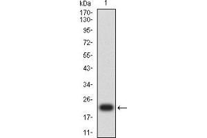 Western blot analysis using BRIP1 mAb against human BRIP1 (AA: 904-986) recombinant protein.