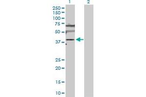 Western Blot analysis of SLC25A6 expression in transfected 293T cell line by SLC25A6 MaxPab polyclonal antibody. (SLC25A6 Antikörper  (AA 1-298))