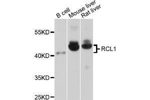 Western blot analysis of extracts of various cell lines, using RCL1 antibody (ABIN1875879) at 1:1000 dilution. (RCL1 Antikörper)