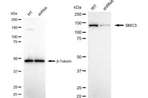 Western blotting analysis using SMC3 antibody (ABIN7800448). (Rekombinanter SMC3 Antikörper)