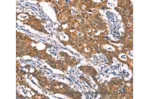 Immunohistochemistry of Human brain  using CYLD Polyclonal Antibody at dilution of 1:35 (CYLD Antikörper)